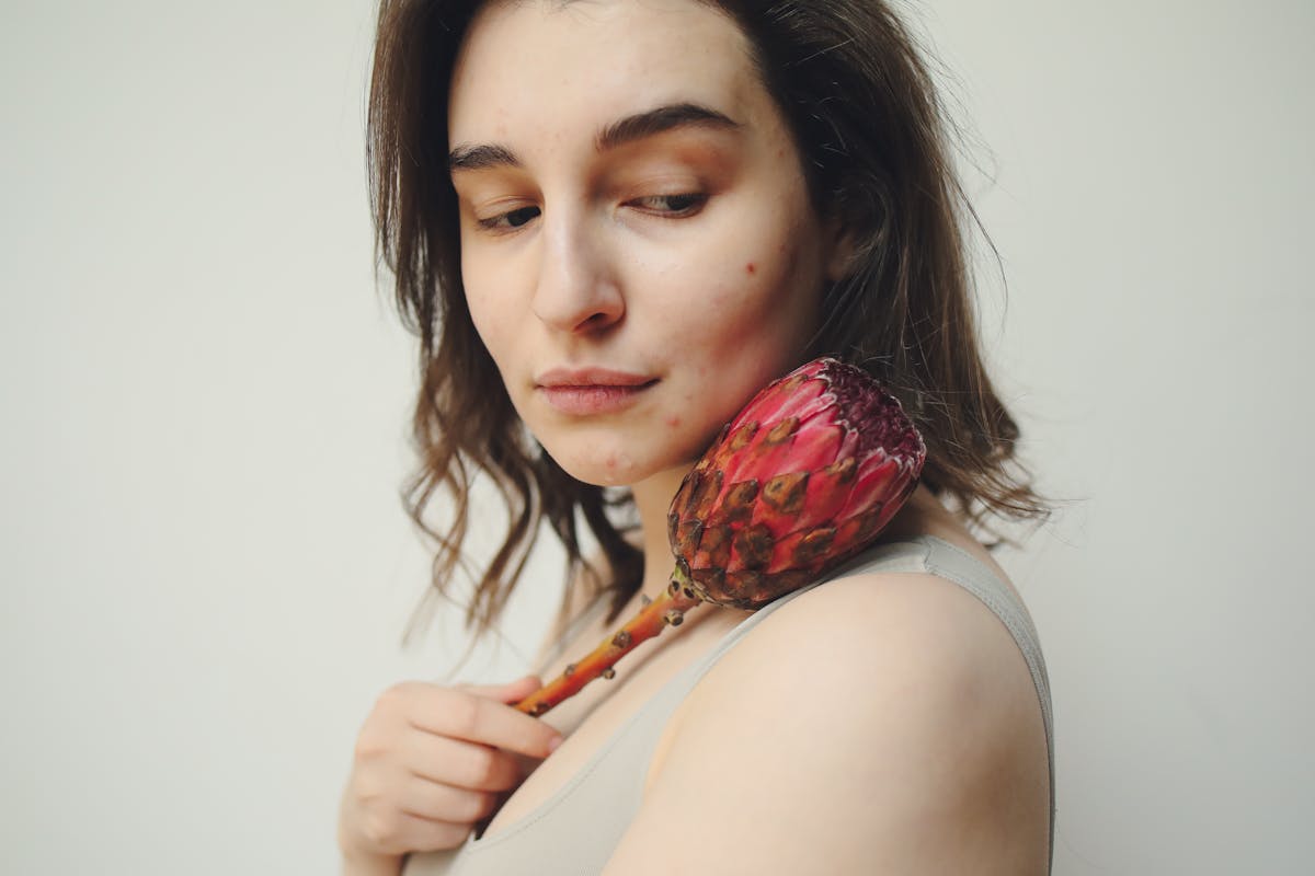 A woman with acne holding a protea flower, gazing thoughtfully.