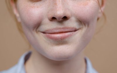 Najczęstsze błędy w pielęgnacji cery trądzikowej