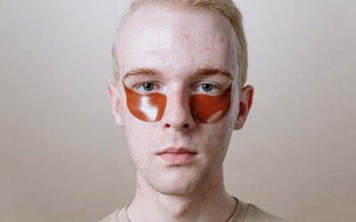 Jak skutecznie radzić sobie z nagłym wysypem niedoskonałości